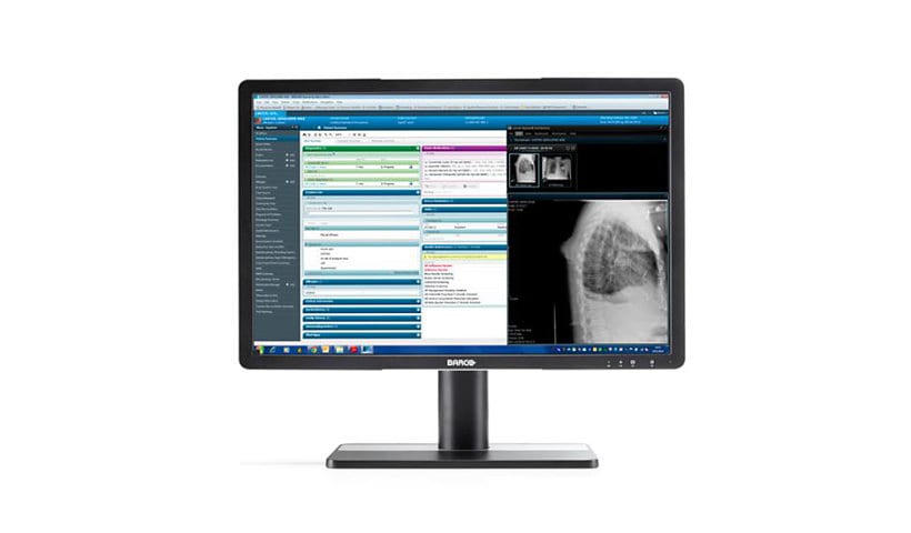Barco Eonis 21.5" LCD (MDRC-2222) Clinical Display