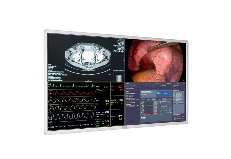 Barco 55" 4K UHD Large Screen Surgical Display