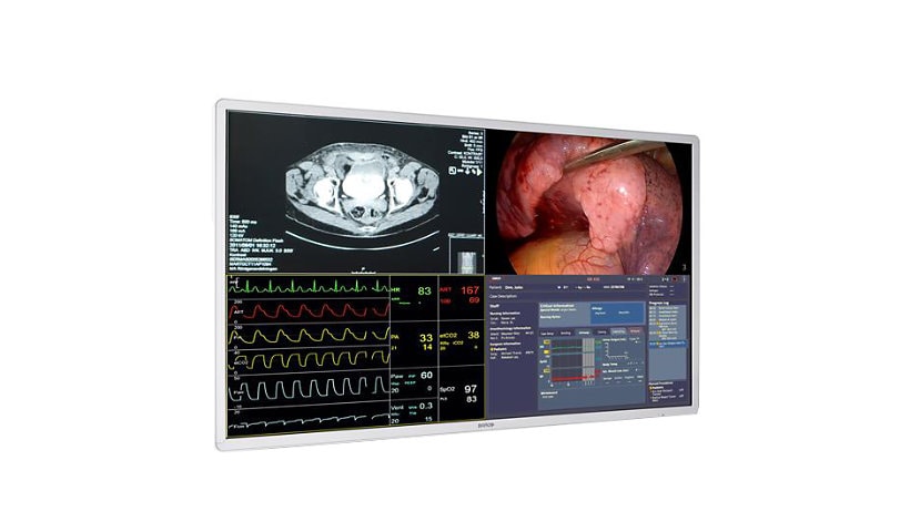 Barco 55" 4K UHD Large Screen Surgical Display