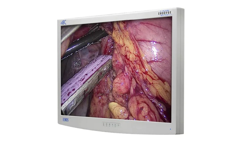NDS EndoVue Plus - LED monitor - 4K - color - 32"