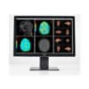 Barco 30.4" 2560x1600 Radiology Monitor