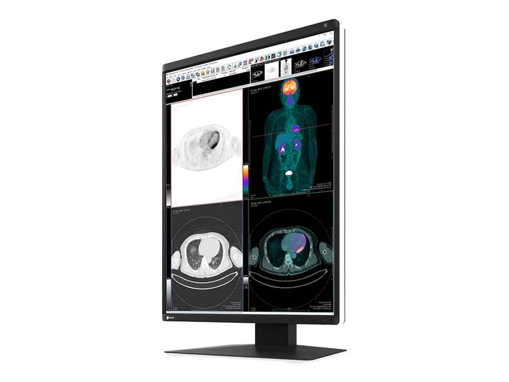 EIZO RadiForce RX370 - LED monitor - 3MP - color - 21.3"