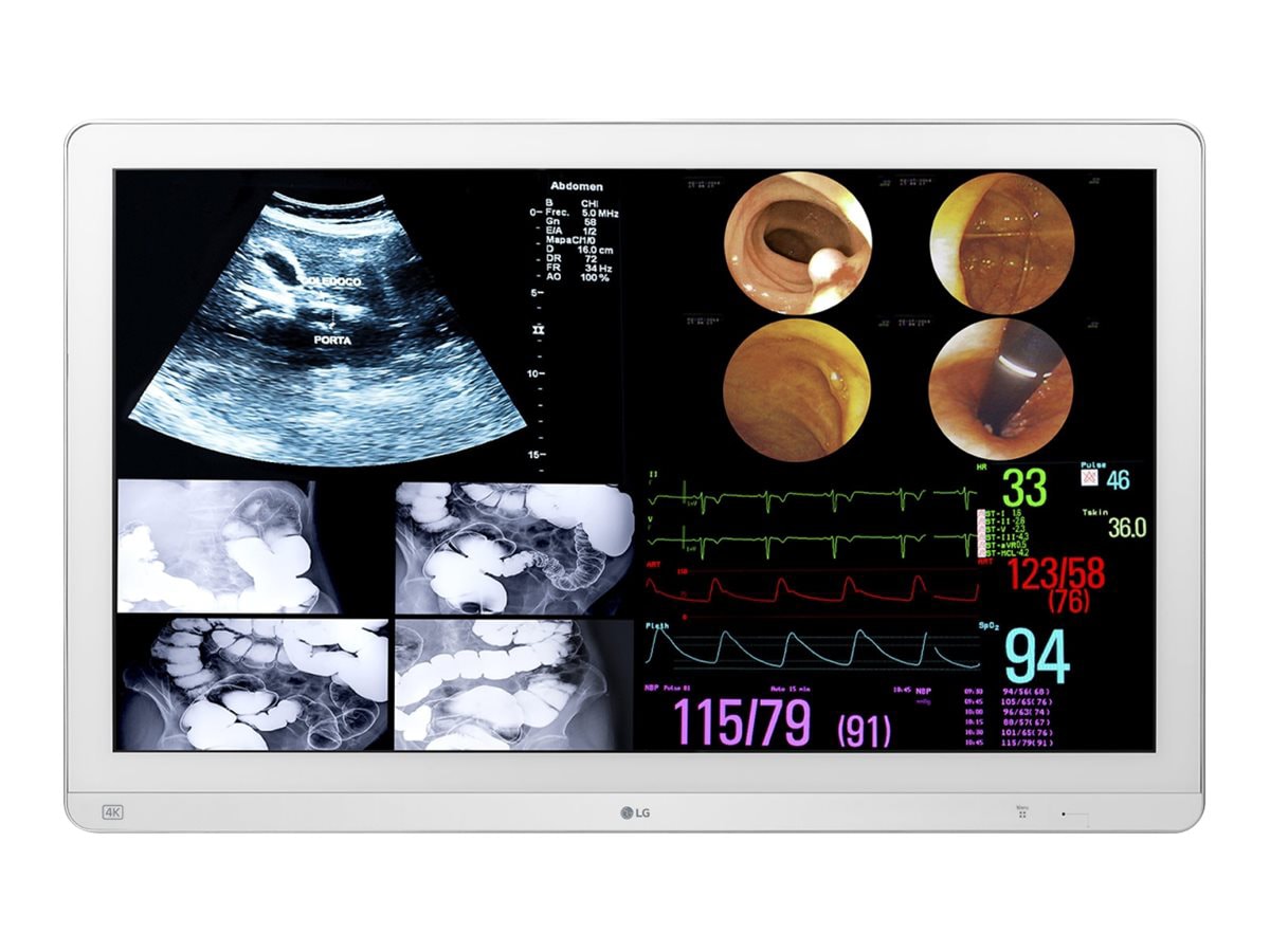 LG 31.5IN 4K IPS SURGICAL MONITOR