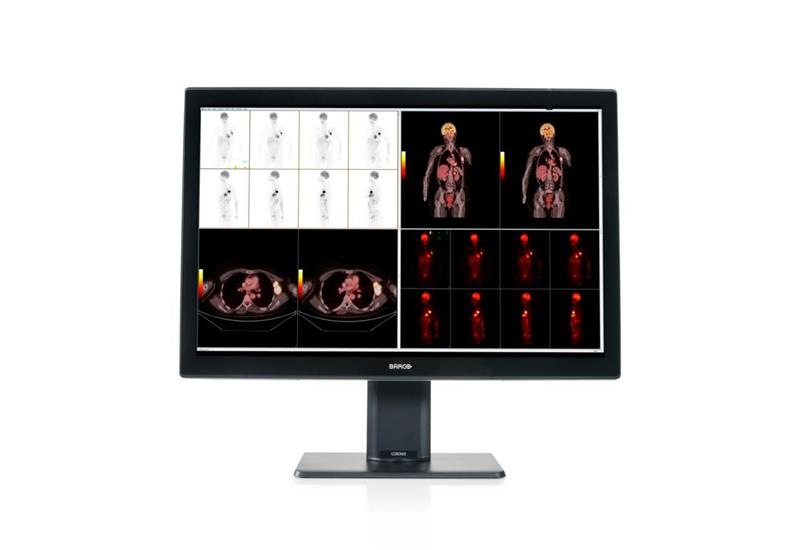 HP Barco Coronis Fusion 6MP Diagnostic Color Display - No Card