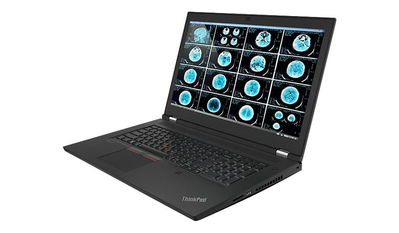 Lenovo ThinkPad P17 Gen 2 - 17.3" - Intel Core i9 11950H - vPro - 32 GB RAM - 1 TB SSD - US