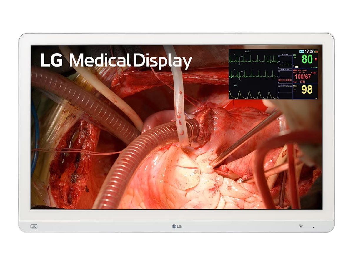 LG 27" 4K UHD VA Surgical Monitor - White