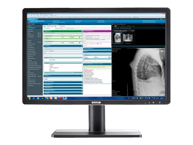 Barco Eonis 22" 2MP Color Clinical Display - Black