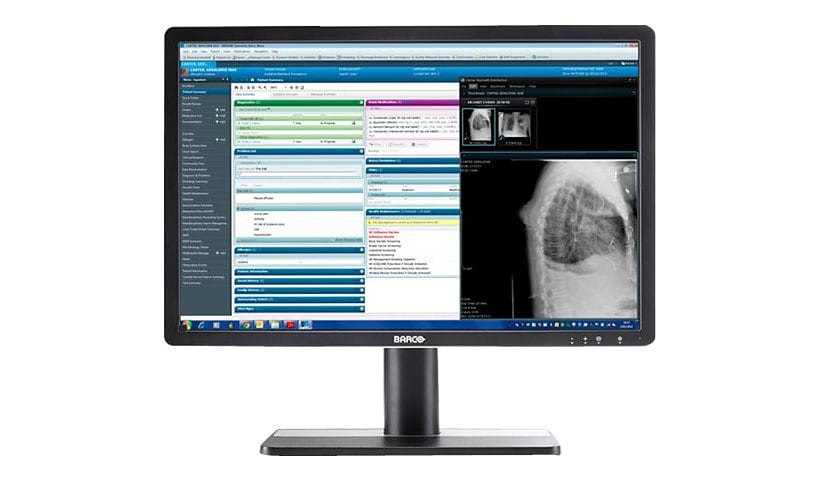 Barco Eonis 22" 2MP Color Clinical Display - Black