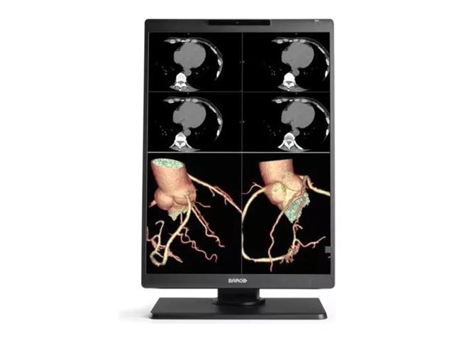 Barco Nio MDNC-3521 - LED monitor - 3MP - color - 21.3"