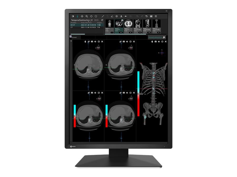 EIZO RadiForce MX217 - LED monitor - 2MP - color - 21.3