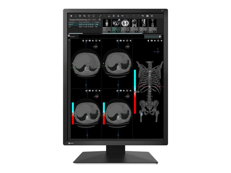 EIZO RadiForce MX215 21.3inch 医用 医療用 縦横チルト DICOM Part14対応 1600×1200 IPS LED 同梱不可