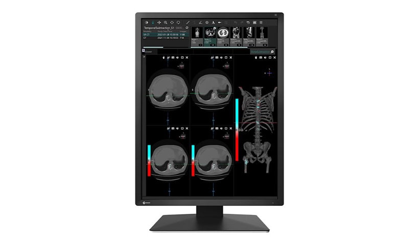 EIZO RadiForce MX217 - LED monitor - 2MP - color - 21.3"