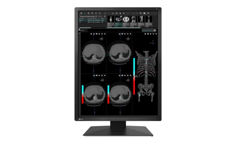 EIZO RadiForce MX217 - LED monitor - 2MP - color - 21.3