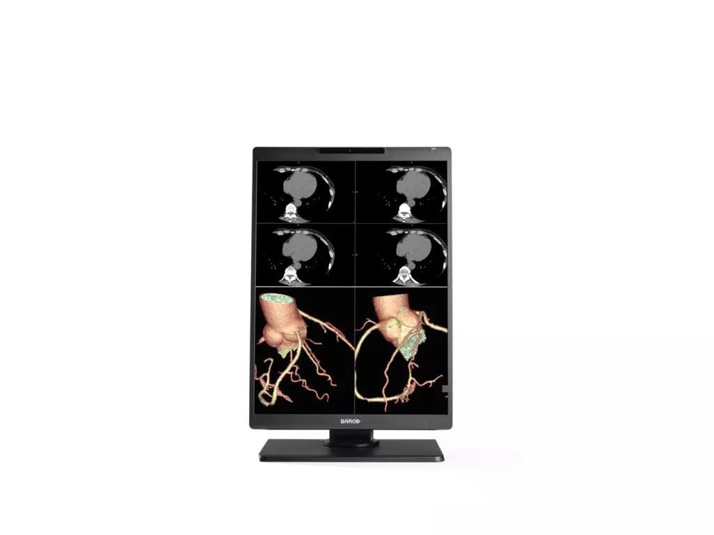 Barco Nio Color 21" 3MP Single Head Radiology Display - No Card/Cover