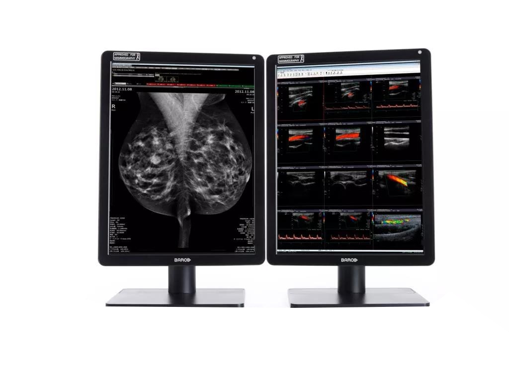 Barco Nio Color 21.3" 5.8MP Dual Head High Bright LCD Display - No Card/Cov