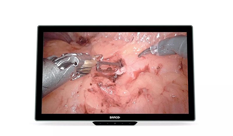 BARCO 27IN SURGICAL MEDICAL DISPLAY