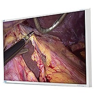 NDS Surgical Imaging EndoVue Plus 55" 4K Medical Grade Display