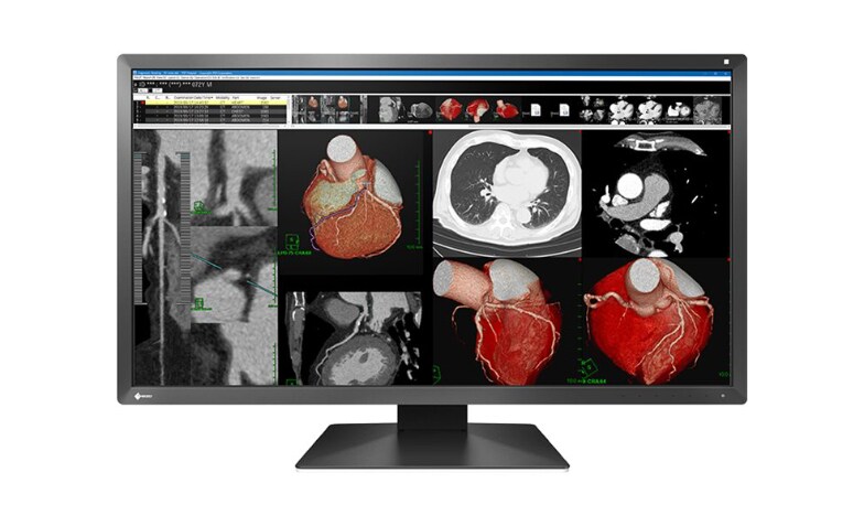 EIZO RadiForce MX317W - LED monitor - 4K - 8MP - color