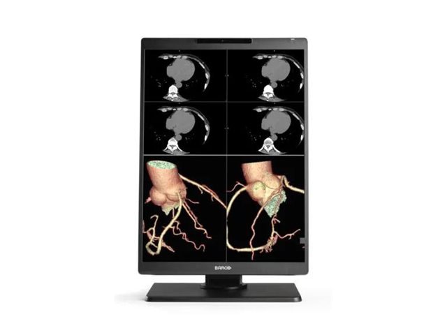 Barco Nio Color 3MP MDNC-3521 - LED monitor - 3MP - color - 21"