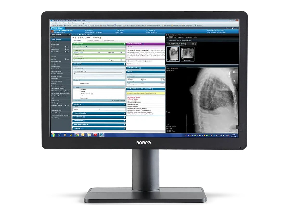 Barco Eonis MDRC-2424 - LCD monitor - WUXGA - 2MP - color - 24"