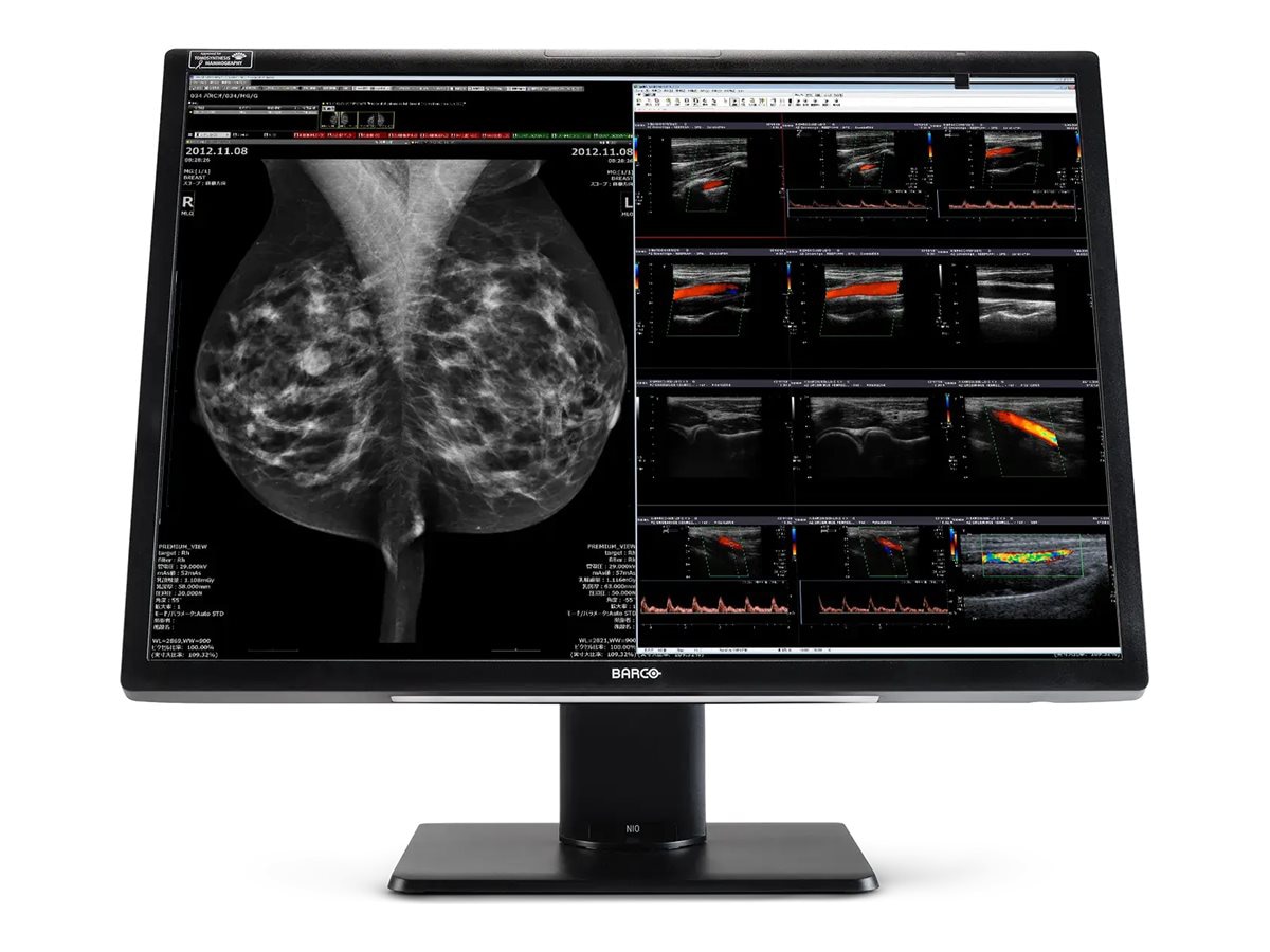 Barco Nio Fusion MDNC-12130 - LCD monitor - 12MP - color - 30"