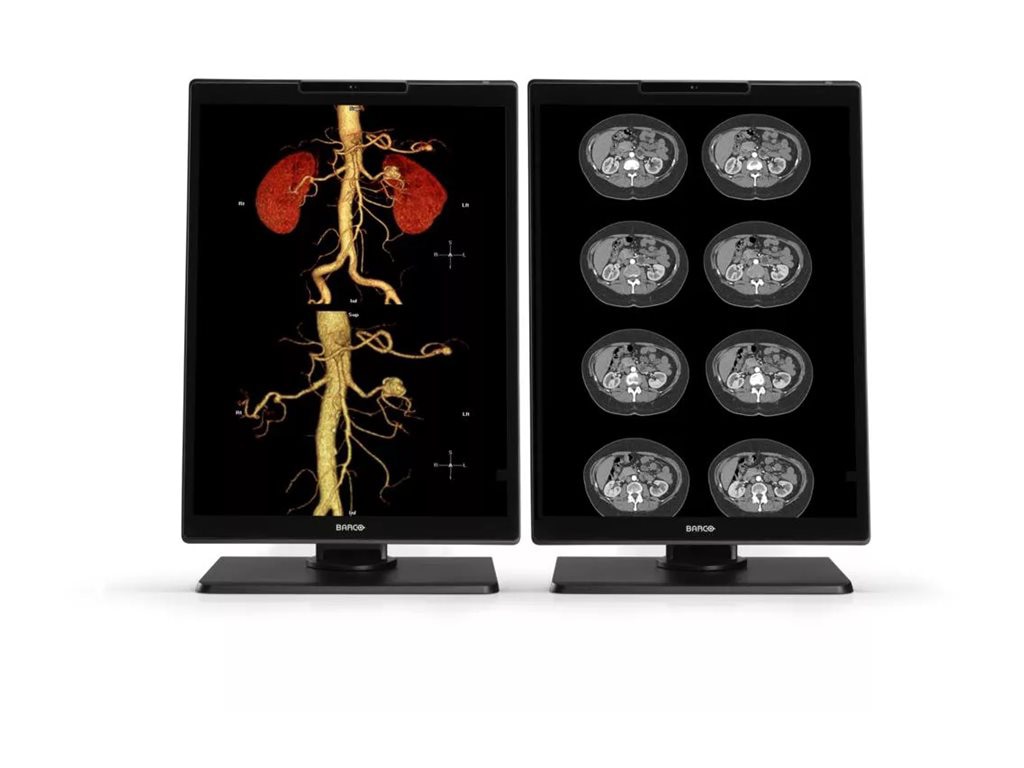 Barco Nio MDNC-3521 - LED monitor - 3MP - color - 21"