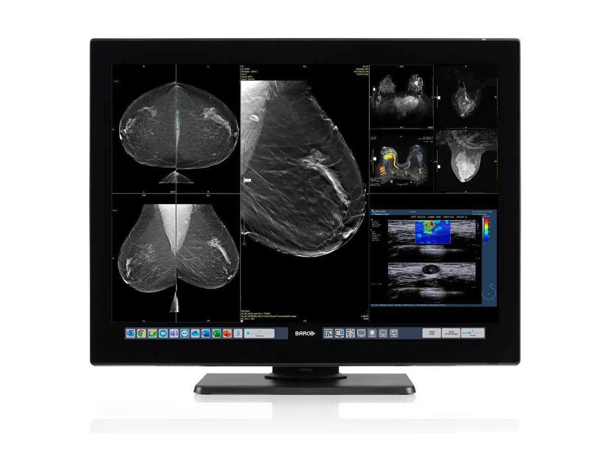Barco Nio Color 3MP MDNC-3521 - LED monitor - 3MP - color - 21"