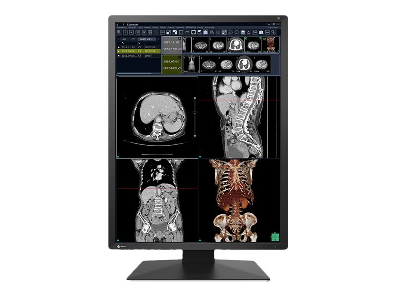 EIZO RadiForce RX270-BK - LCD monitor - 2MP - color - 21.3"