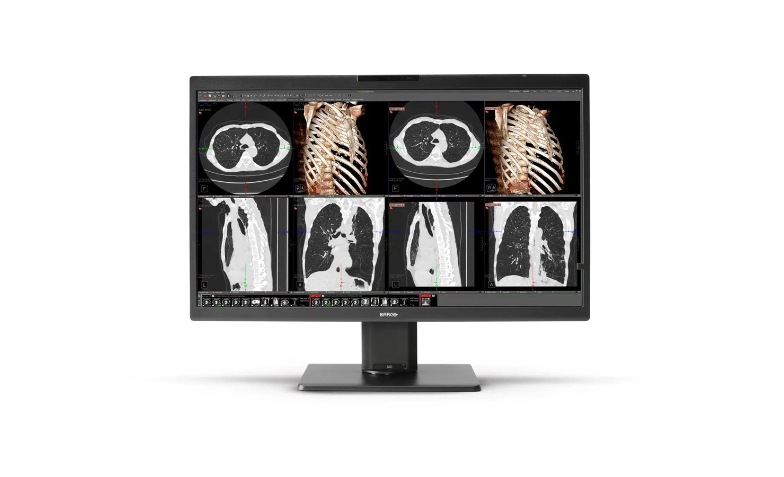 Barco Nio Color 8MP MDNC-8132 - LCD monitor - 4K - 8MP - color