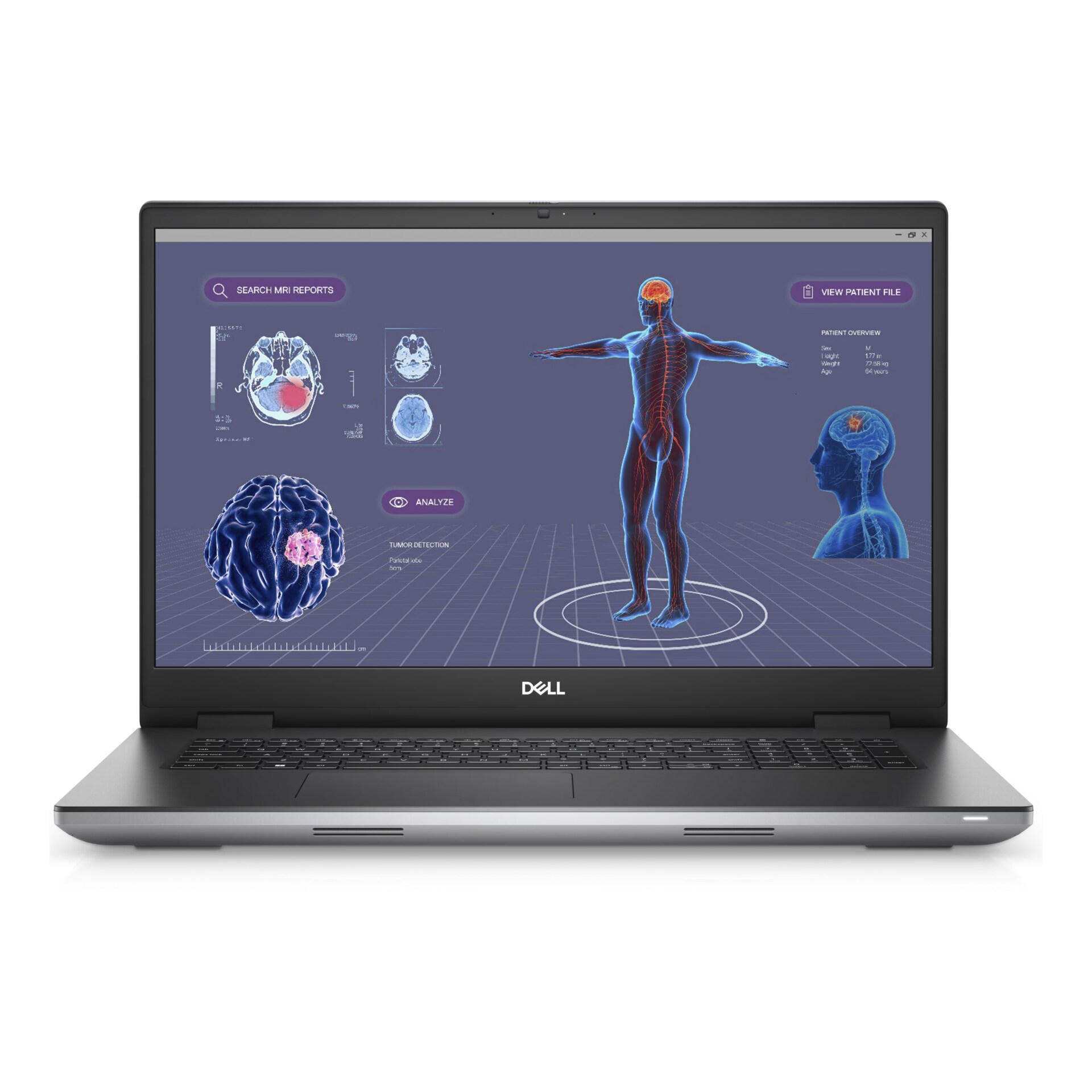 Dell Mobile Precision Workstation 7780 CTOG