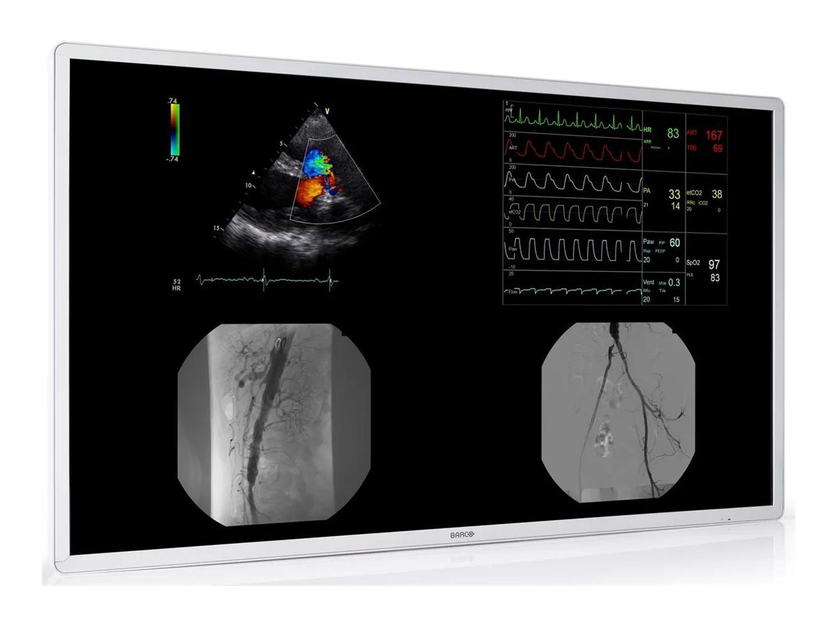 Barco MDAC-8355 SPIB - LCD monitor - 4K - 8MP - color - 55"