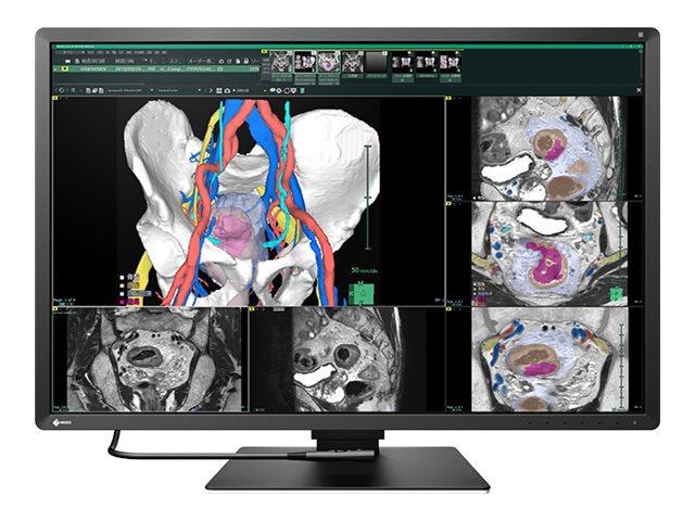 EIZO RadiForce RX670 - LED monitor - 30"