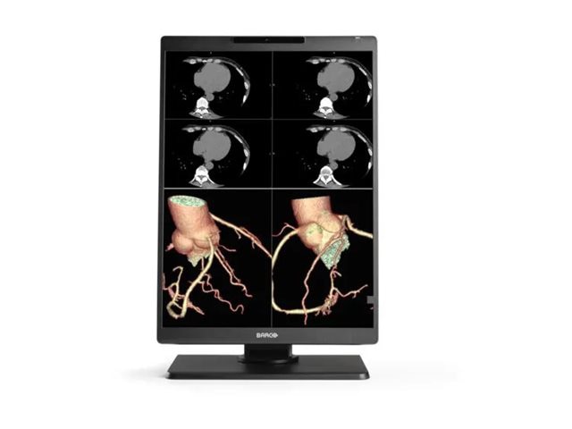 Barco Nio Color 2MP - LED monitor - 2MP - color - 21"