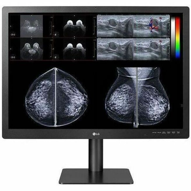 LG 31HN713D-B 31" Class LCD Monitor - 16:9 - Matte Black